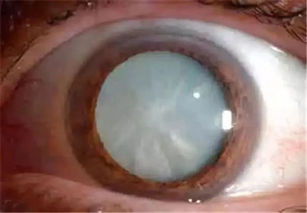 人体补硒每天最低多少(缺硒地区的人应该天天补硒吗)-硒宝网