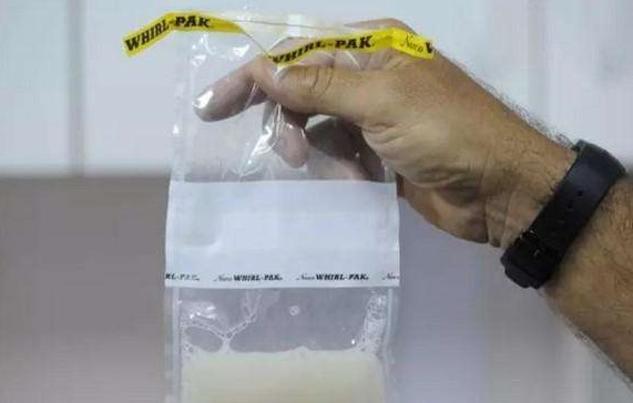 补硒 有助精子质量吗（弱精补硒）-硒宝网