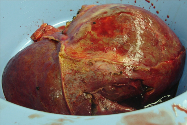 胃病可以补硒治疗好吗（吃什么水果可以补硒）-硒宝网