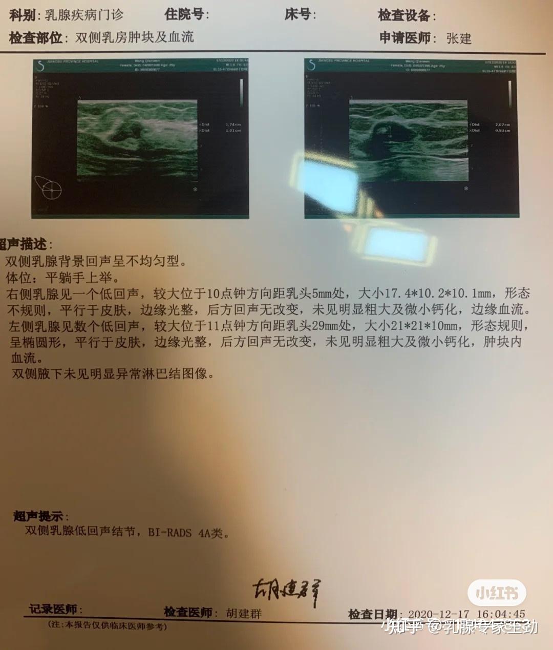 乳腺小叶增生怎么补硒(乳腺增生吃硒有效果吗)-硒宝网