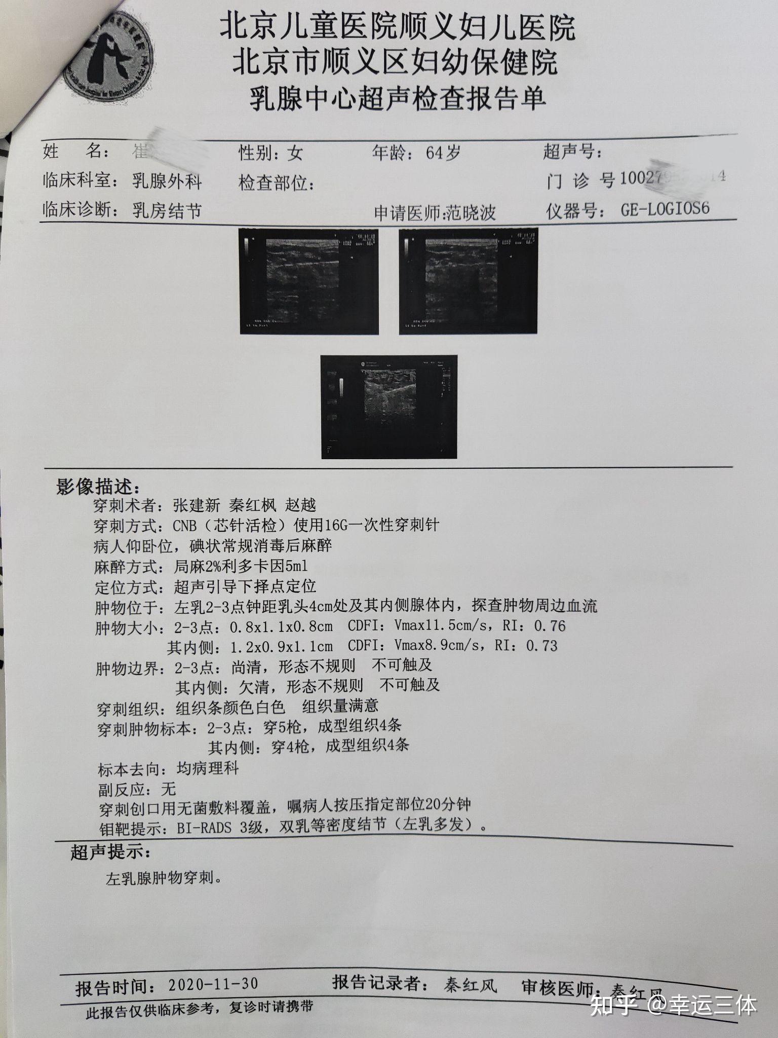 乳腺小叶增生怎么补硒(乳腺增生吃硒有效果吗)-硒宝网