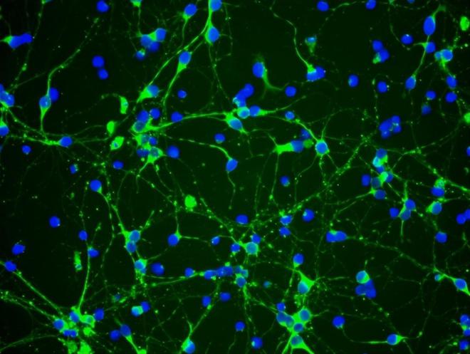 补硒元素真能抑制癌症(癌症抑制能补元素硒吗)-硒宝网
