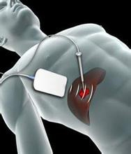 肝癌患者补麦芽硒好吗(肝癌吃麦片)-硒宝网