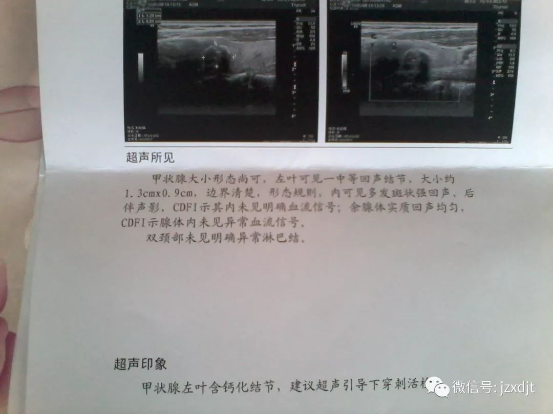 甲状腺结节要终身补硒(终身补甲状腺结节硒要吃多久)-硒宝网