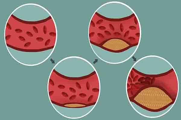 硒元素每天最高补多少(每天补充硒元素)-硒宝网