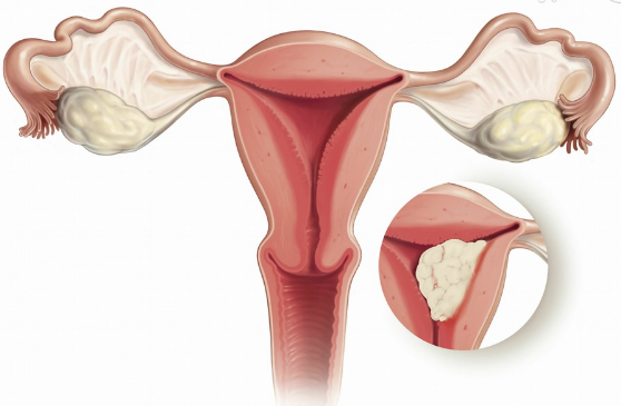 hpv补硒有什么好处(补硒对hpv有效果吗)-硒宝网