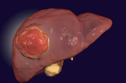补硒过量导致肝部不适（过量硒对肝的影响）-硒宝网