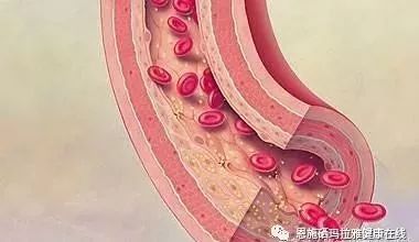 过量补硒会有什么后果(过量补硒有副作用吗)-硒宝网