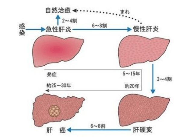 补硒过量导致肝部不适(补硒过度会硒中毒吗)-硒宝网