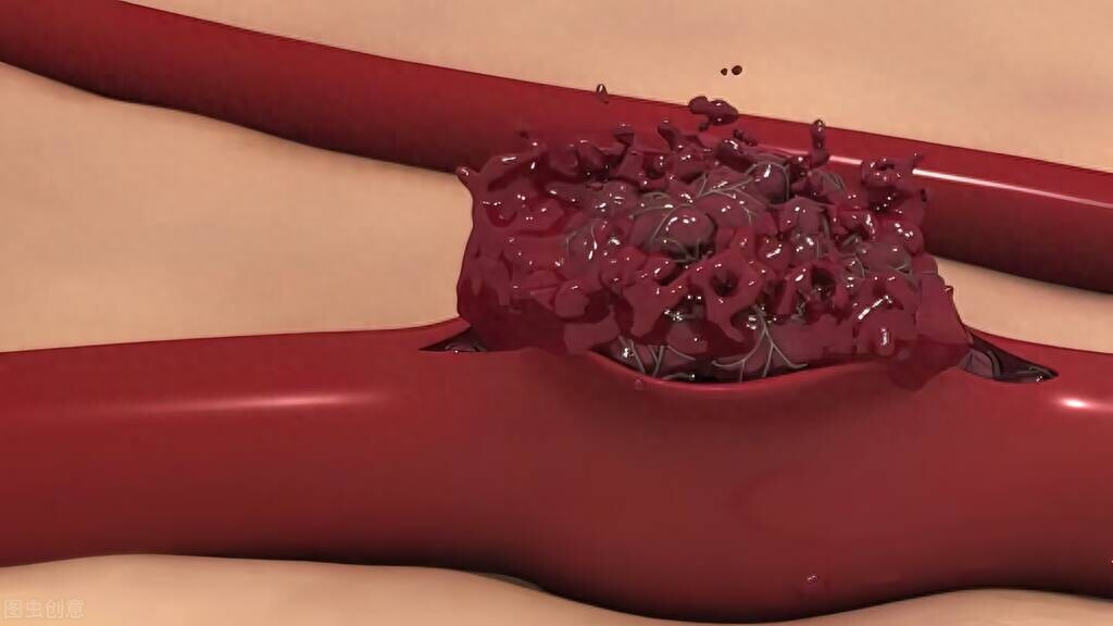 补硒会得甲状腺结节吗（全民补硒工程会犯法吗）-硒宝网