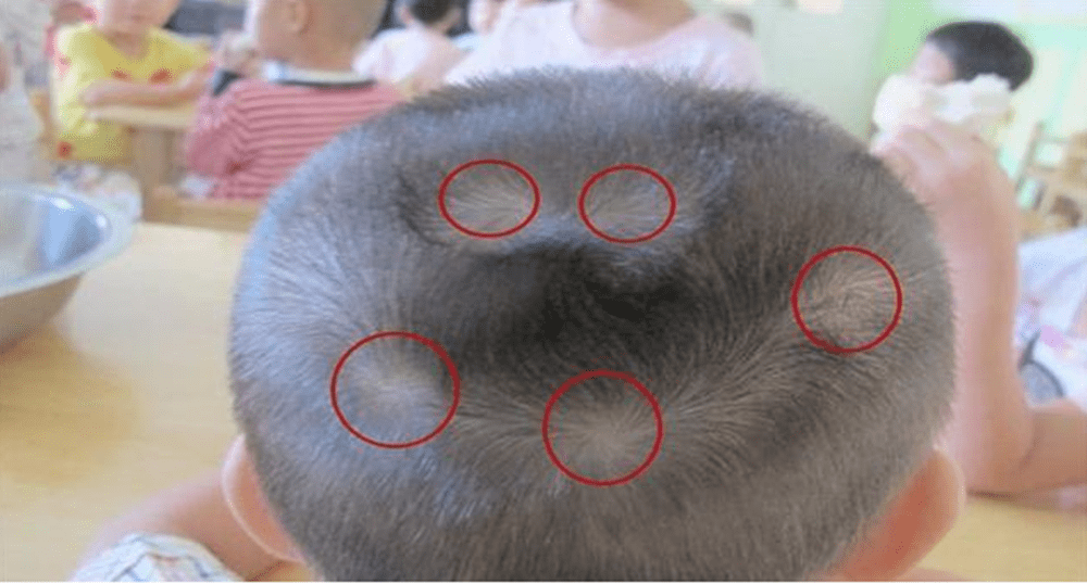 宝宝缺钙铁锌硒怎么补（宝宝缺钙和锌怎么办）-硒宝网