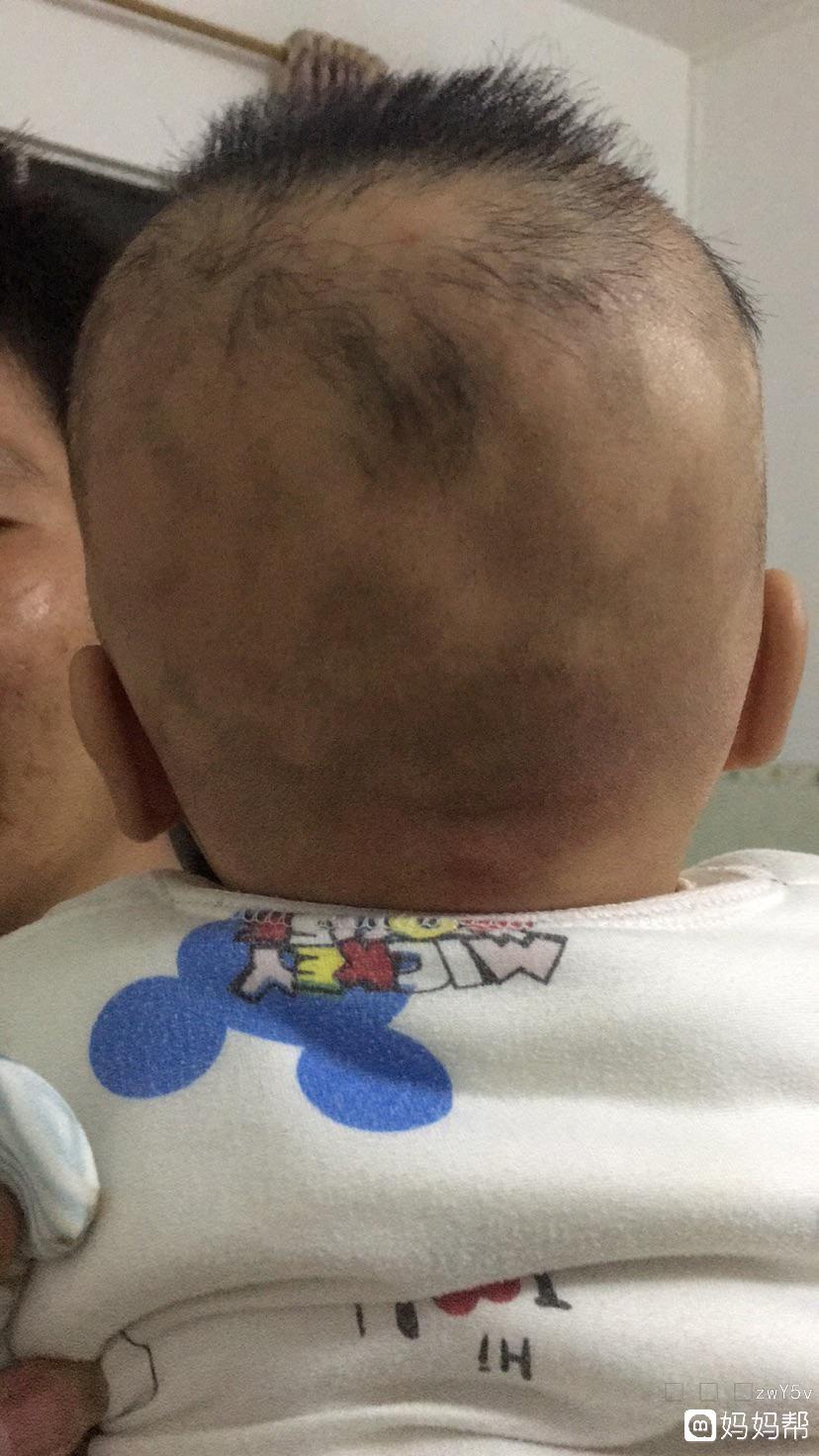 宝宝缺钙铁锌硒怎么补（宝宝缺钙和锌怎么办）-硒宝网