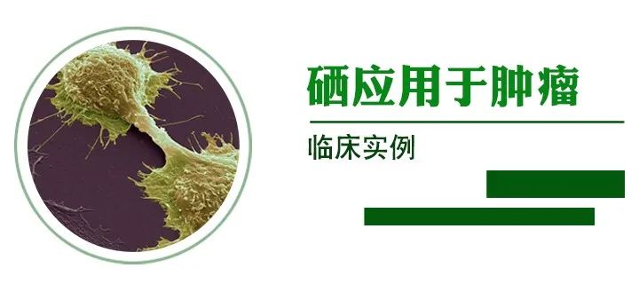 肿瘤病人补硒疗效案例(肿瘤患者补硒)-硒宝网