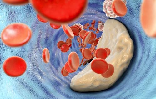 纤维结合蛋白偏低补硒（蛋白纤维偏低补结合硒有用吗）-硒宝网