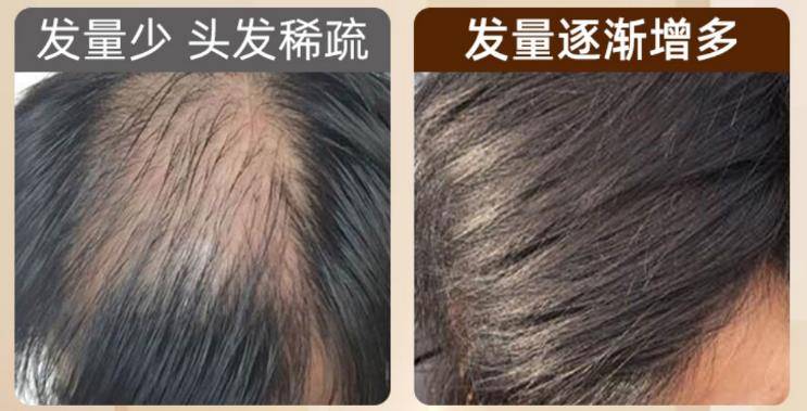 什么牌子补硒效果最好（硒维康口嚼片哪个牌子好）-硒宝网