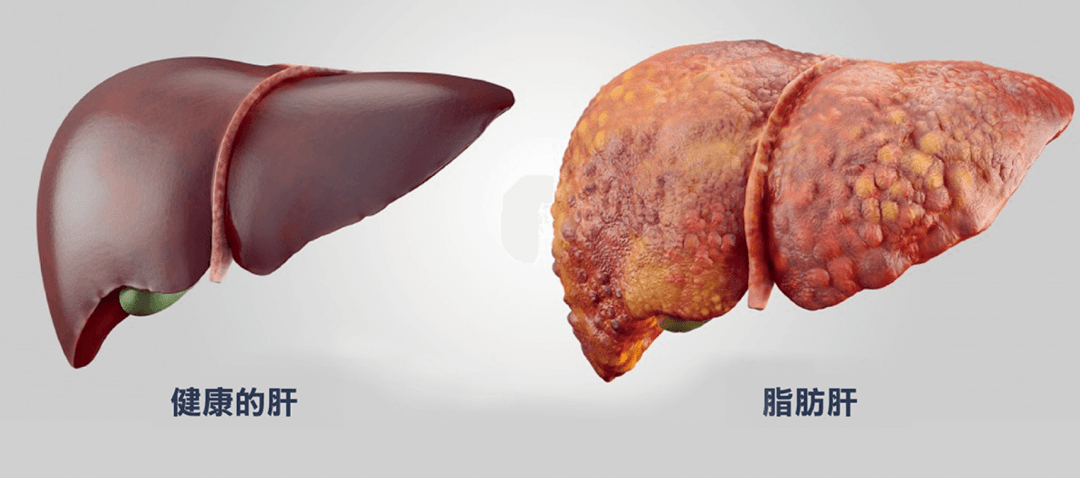 胃癌化疗期间补硒食物（胃癌补硒有用吗）-硒宝网