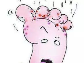 补硒补维生素吃什么药（补维生素药吃硒片可以吗）-硒宝网