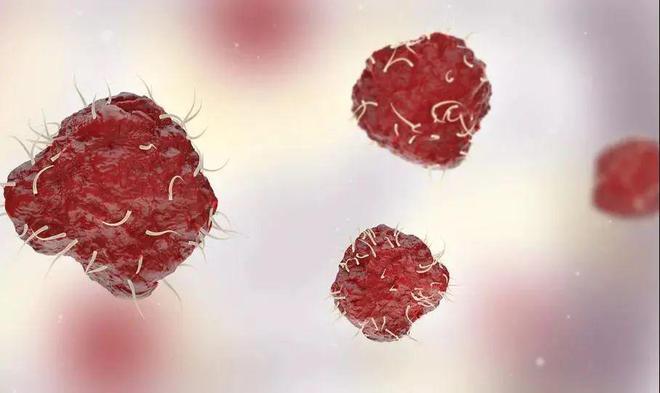 癌症补硒案例分析报告（补硒能治疗乙肝吗）-硒宝网