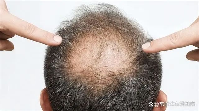 补硒的食物有什么作用（补食物作用硒有什么好处）-硒宝网