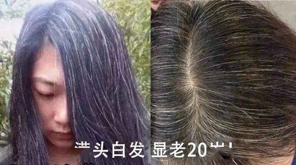 补硒元素能治疗白发吗（白发能补元素治疗硒吗）-硒宝网