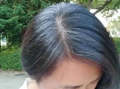 补硒元素能治疗白发吗（白发能补元素治疗硒吗）-硒宝网