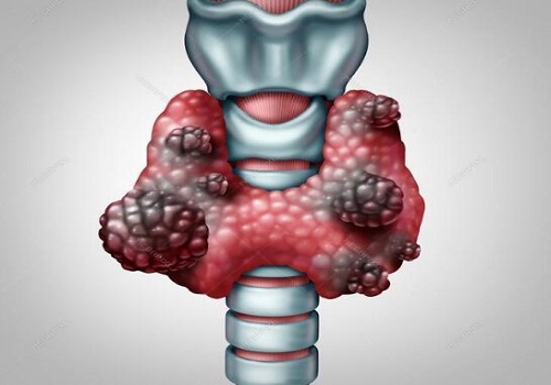 甲状腺肿块可以补硒吗(补甲状腺肿块硒可以吗)-硒宝网