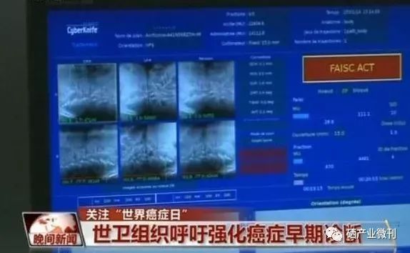 甲状腺肿块可以补硒吗(补甲状腺肿块硒可以吃多久)-硒宝网