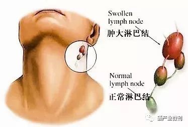甲状腺肿块可以补硒吗(补甲状腺肿块硒可以吃多久)-硒宝网