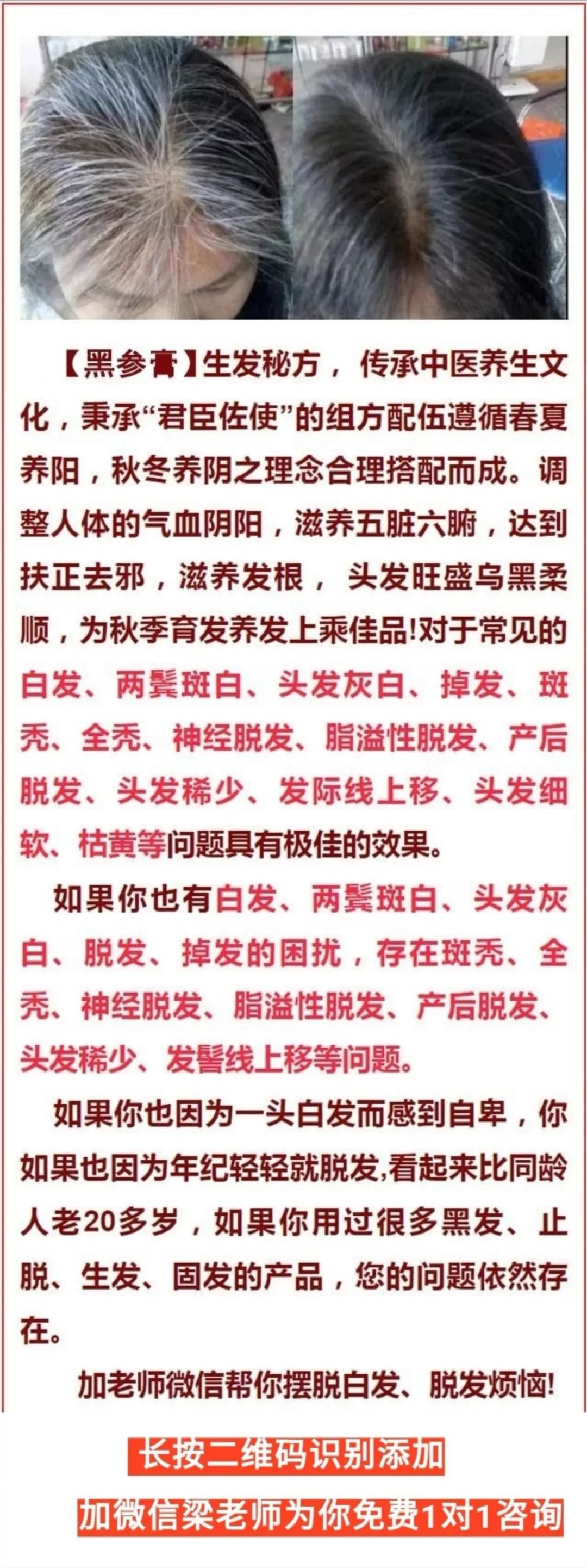 补硒元素能治疗白发吗（补硒治疗妇科病吗）-硒宝网