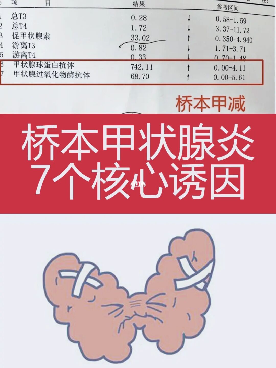 甲亢桥本病可以补硒吗（补硒可以补多长时间）-硒宝网