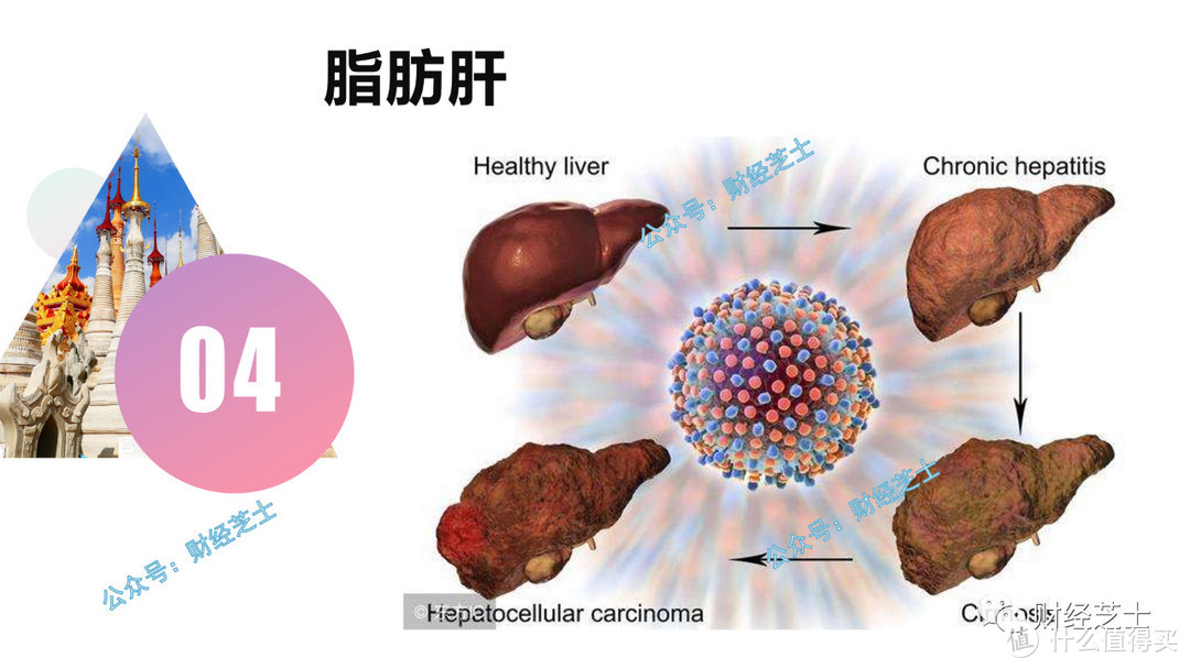 补硒能有效预防痛风吗（预防能补痛风有效硒片吗）-硒宝网