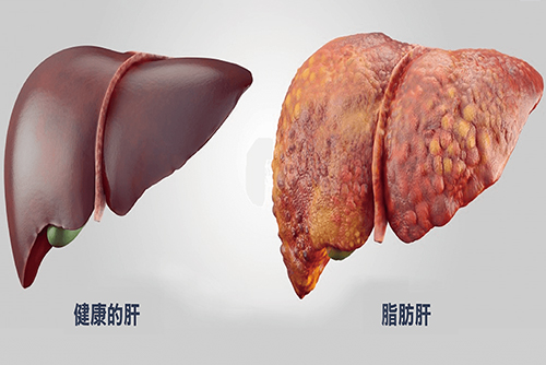 得了肝囊肿需要补硒吗(肝补囊肿得需要硒片多久)-硒宝网