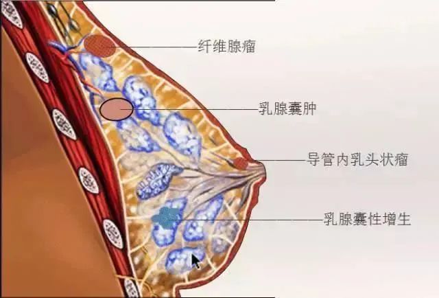 补硒会加重乳腺增生吗（硒对乳腺增生有效果吗）-硒宝网