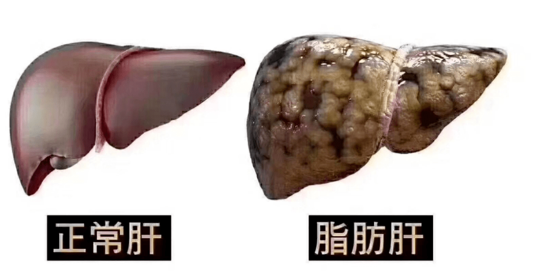 补硒会加重肝脏负担吗（补硒对肝病有效吗）-硒宝网