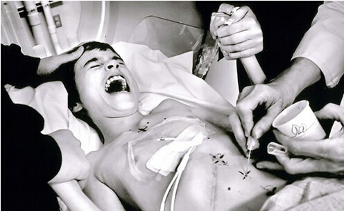 癌症晚期补硒有什么好(癌症晚期补好硒有什么好处)-硒宝网