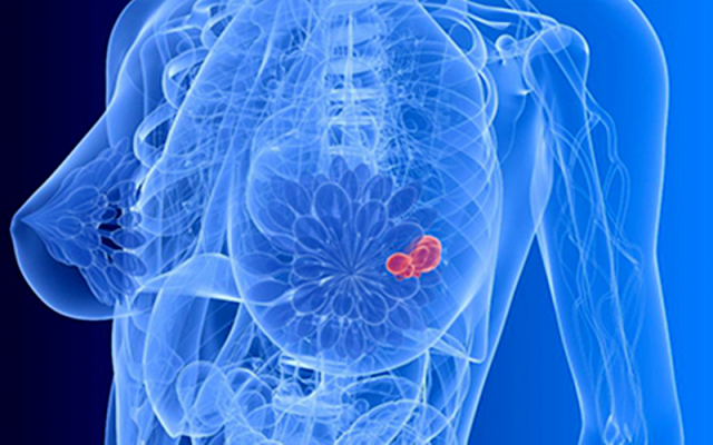 乳房有疾病可以补硒吗(补硒可以改善乳腺结节吗)-硒宝网