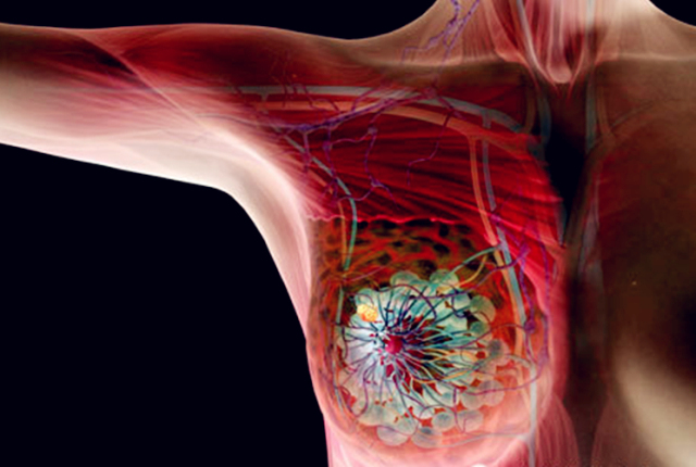 乳房有疾病可以补硒吗(补硒可以改善乳腺结节吗)-硒宝网