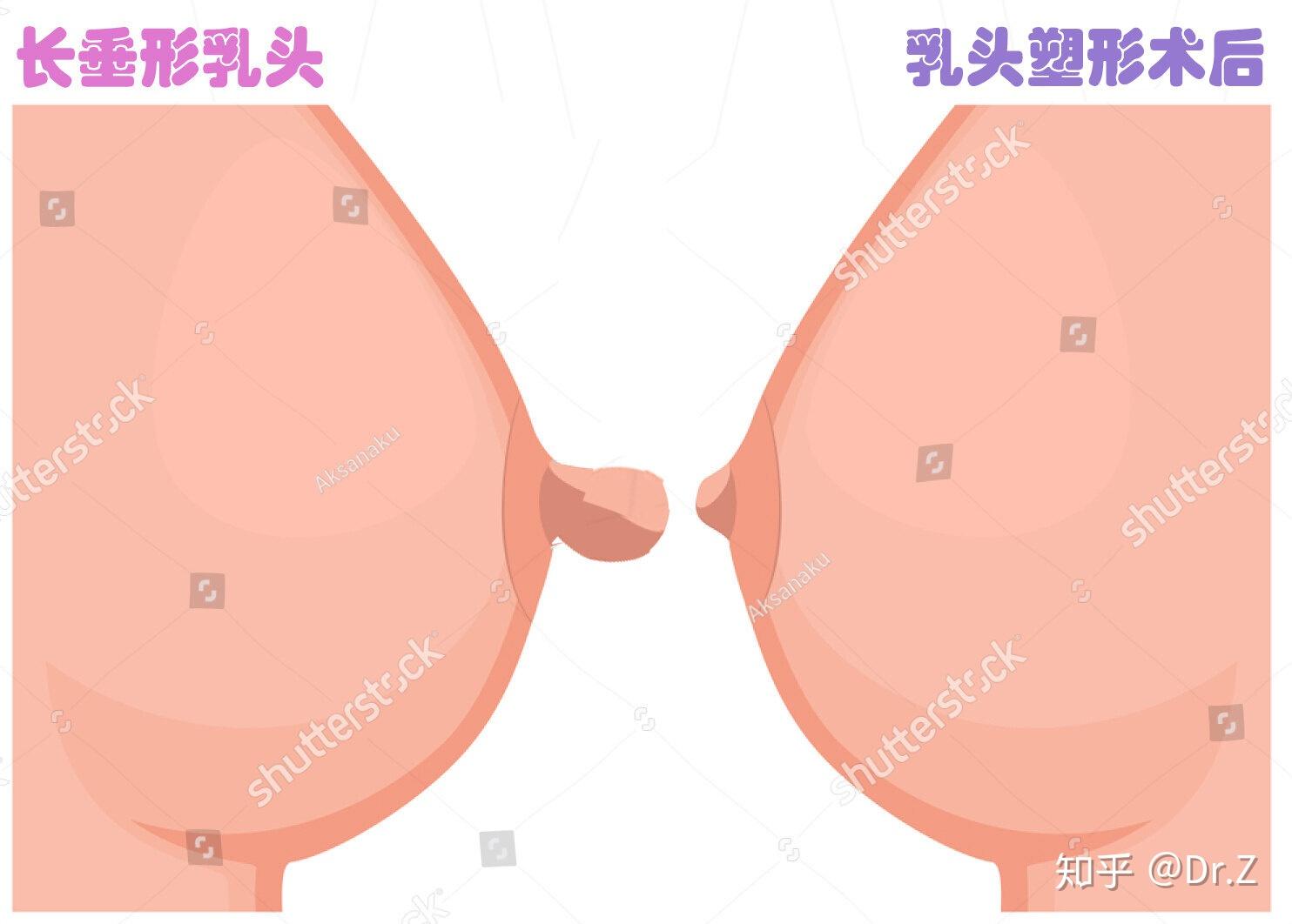 为什么补硒过后乳房痛（牙齿补过后咬硬东西痛）-硒宝网