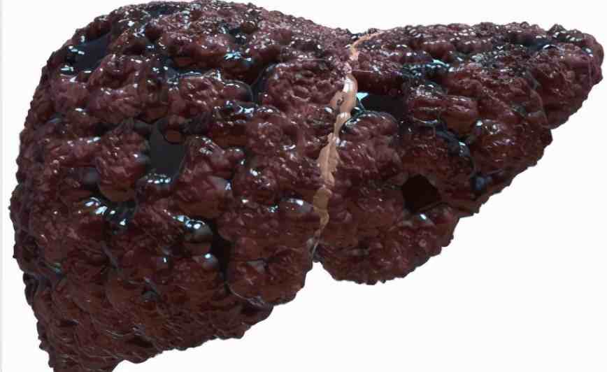 预防癌症补什么硒最好(补硒对癌症有什么好处)-硒宝网