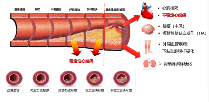 血脂异常还可以补硒嘛（补异常血脂硒可以吗）-硒宝网