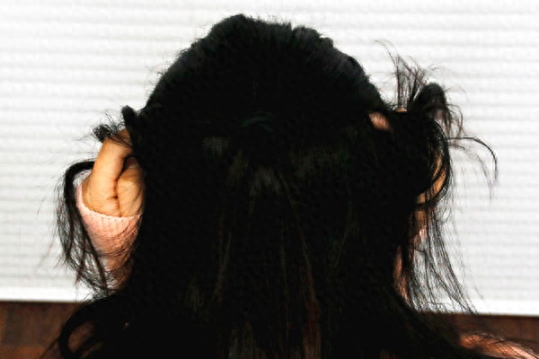 补硒药可以治甲状腺嘛(甲状腺吃补硒的药)-硒宝网