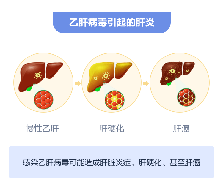 乙肝肝硬化怎么补硒好(补硒保健品什么牌子好)-硒宝网