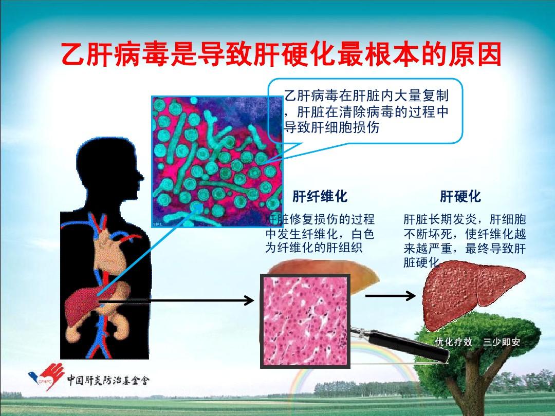 乙肝肝硬化怎么补硒好(补硒保健品什么牌子好)-硒宝网
