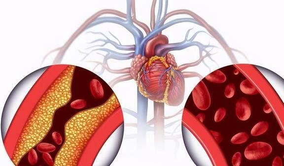 中老年需要补叶酸和硒（叶酸中老年是要经常服吗）-硒宝网