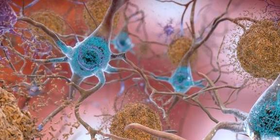 中老年需要补叶酸和硒(中老年人补叶酸)-硒宝网