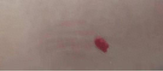 补硒后全身瘙痒啥情况(皮肤瘙痒是缺硒吗)-硒宝网