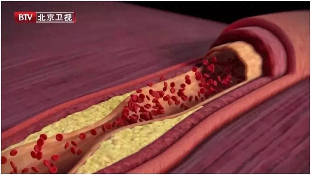 补硒后全身瘙痒啥情况(皮肤瘙痒是缺硒吗)-硒宝网