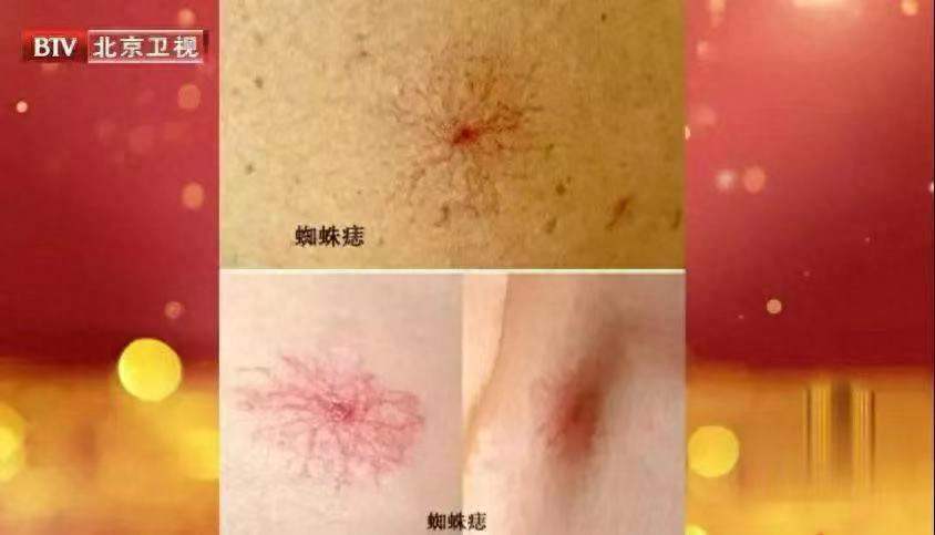 补硒后全身瘙痒啥情况(皮肤瘙痒是缺硒吗)-硒宝网