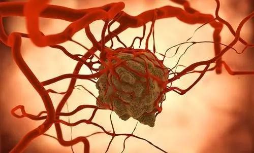 痛风的人补硒有作用吗（硒对痛风有治疗效果吗）-硒宝网