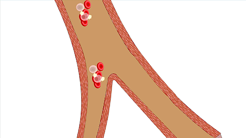 补硒能消除斑块吗女性（补硒能祛斑吗）-硒宝网